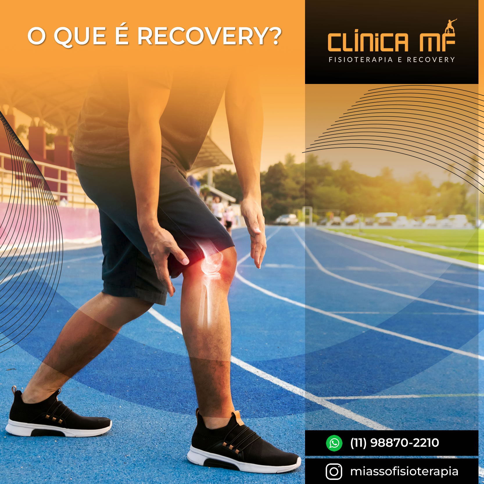 Miasso O que é Recovery na Fisioterapia? - Start Over - Fisioterapia & Recovery